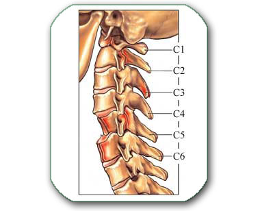Discus hernia: Vratna kičma