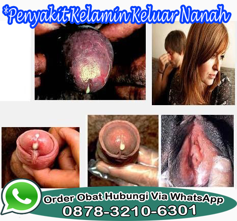 Jamu Atasi Kencing Nanah Jamu Atasi Kencing Nanah
