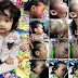 Bayi 10 Bulan Lebam Ditampar Pengasuh