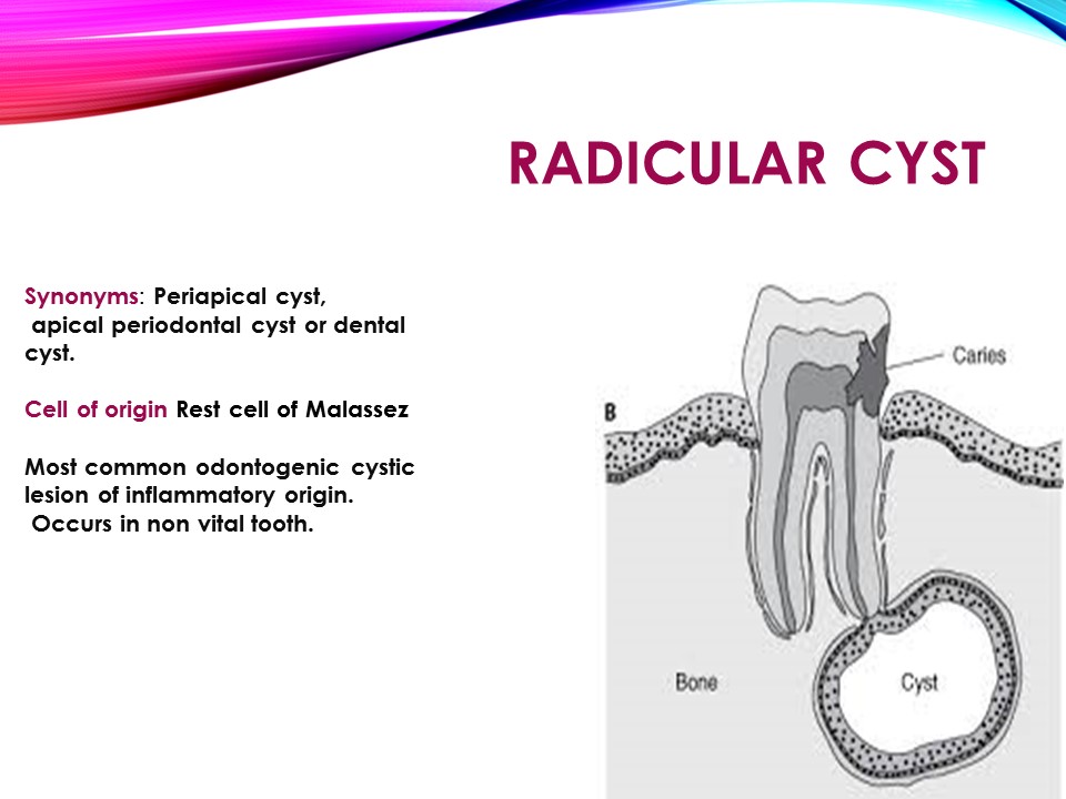 Dentosphere : World of Dentistry: Pathogenesis of 