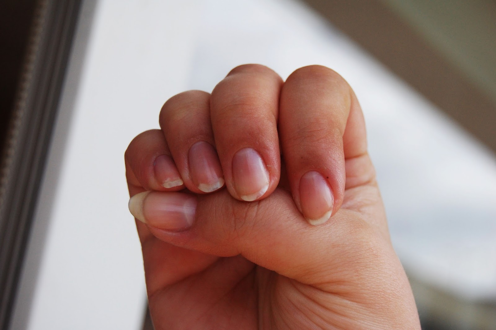 kuracja-nail-tek kuracja-nail-tek