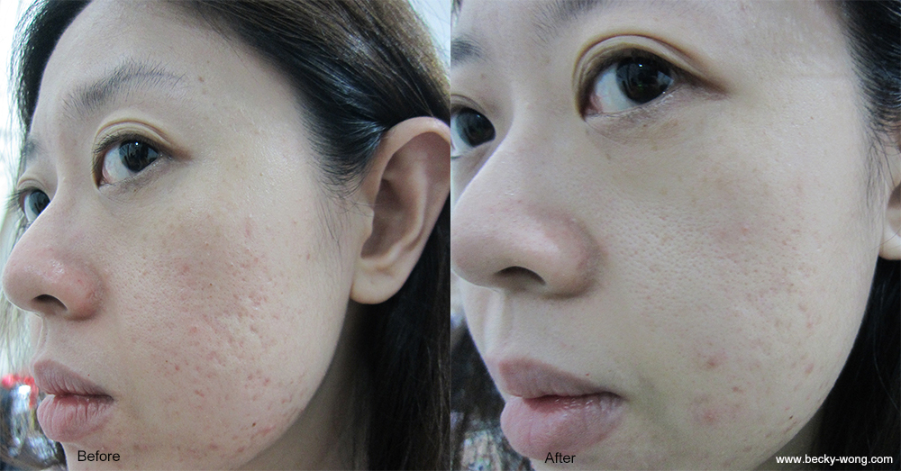 Collagen Cold And Room Temperature Changes Collagen Cold And Room Temperature Changes