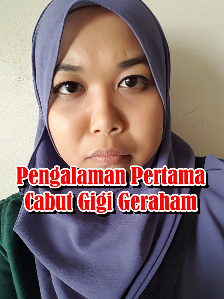 Pengalaman Pertama Cabut Gigi Geraham | Eintan Nurfuzie | Lifestyle