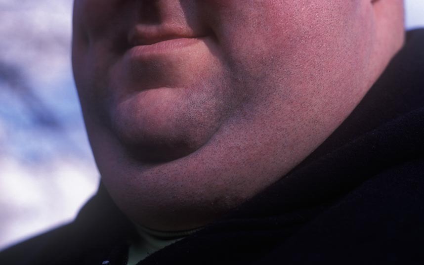 how-to-lose-face-fat-without-surgery-or-pain-get-rid-of-face-fat