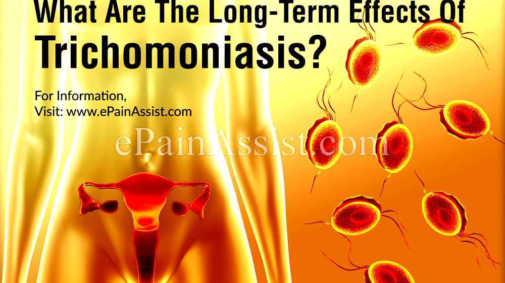 Trichomoniasis