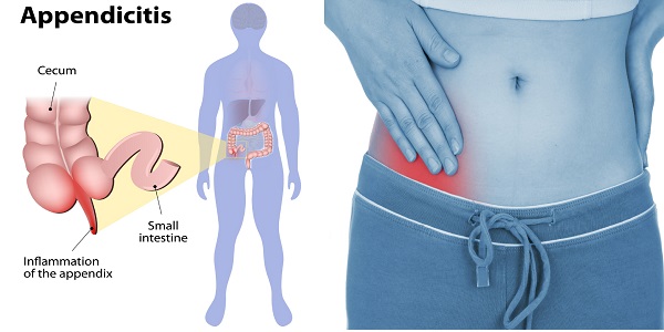 Chronic Stomach Pain After Eating Related Protein Shake Kids Chronic Stomach Pain After Eating Related Protein Shake Kids
