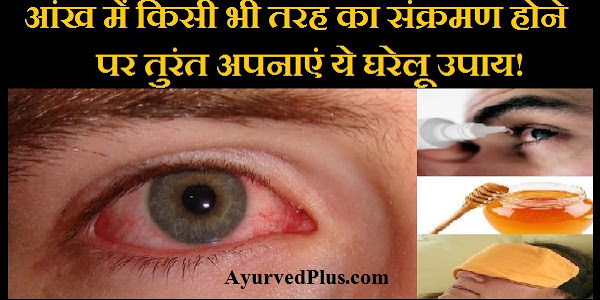 आंख में किसी भी तरह का संक्रमण होने पर तुरंत अपनाएं ये असरदार घरेलू उपाय!