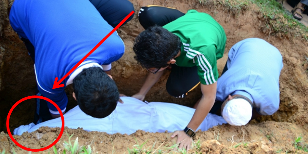 KAMU SEMUA HARUS TAU.. Beginilah Proses Pembusukan Tubuh