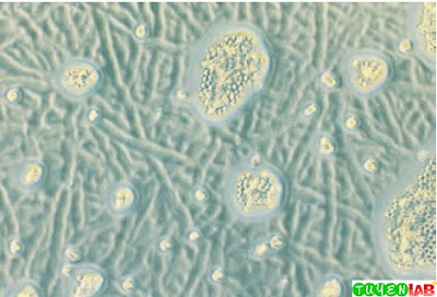 “Tracts” of Acanthamoeba trophozoites “Tracts” of Acanthamoeba trophozoites