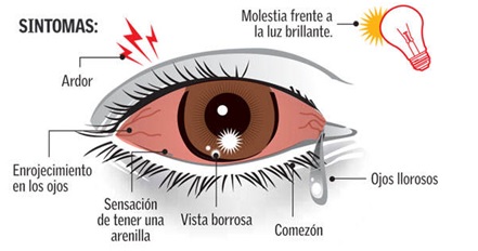 conjuntivitis bacteriana sintomas y signos