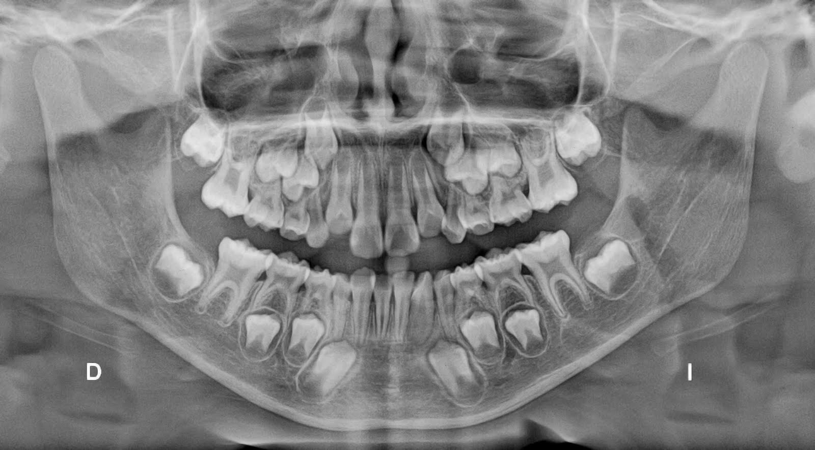 OrthodentDigitalPlus Diagnostico Radiologico Dental