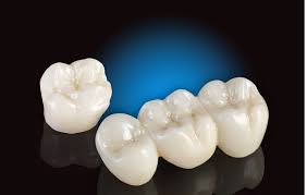Những cách bọc răng bằng sứ và chăm sóc răng miệng tốt Images%2B%252810%2529
