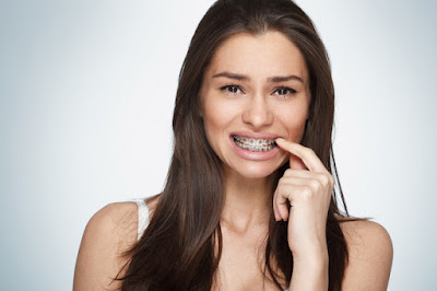 Una higiene para cada tipo de ortodoncia