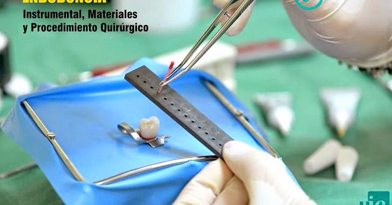 Endodoncia Instrumental Materiales Y Procedimiento Quirúrgico Odonto Tv