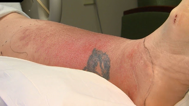 After Reading This You Will Never Get a Pedicure Again : Woman Gets a Life-Threatening Infection After Pedicure After Reading This You Will Never Get a Pedicure Again : Woman Gets a Life-Threatening Infection After Pedicure