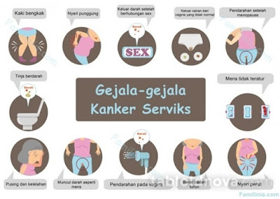 Kanker Serviks Gejala Kanker Serviks