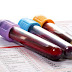 DEPRESSÃO: UM SIMPLES EXAME DE SANGUE INDICA O MELHOR TRATAMENTO