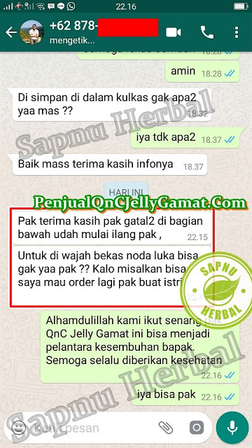 Ahlinya Obat Gatal ~ Testimoni Ahlinya Obat Gatal ~ Testimoni