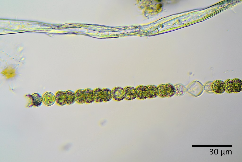 Анабена. Anabaena azollae. anabaena affinis. анабена водоросли. anabaena lemmermanii.