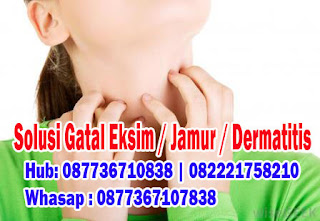 Foto Cara Cepat Menghilangkan Gatal Eksim Di Jari Kaki dan Tangan