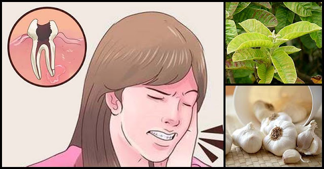 Different Types Of Herbs As Remedy For Toothache Different Types Of Herbs As Remedy For Toothache