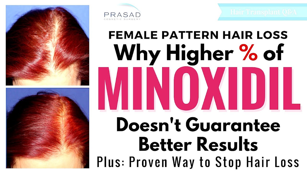 Minoxidil Side Effects Men Effect Choices