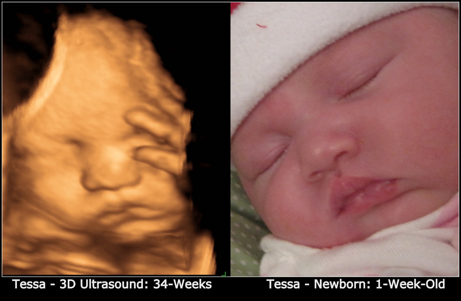 Mommy Said So 3D Ultrasound Photo SidebySide Comparison to My Actual