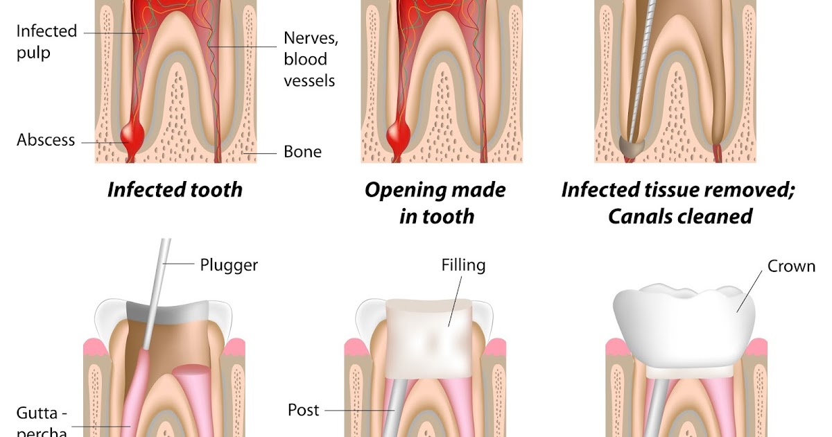 Зуб после душа