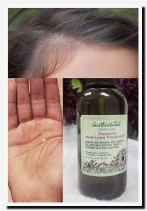 Just Natural Skin Care Reviews Grow New Hair