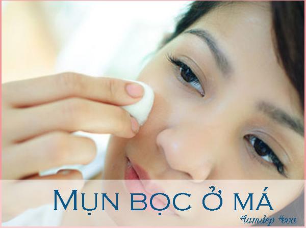 Làm theo cách này hằng ngày đánh bay mụn bọc Làm theo cách này hằng ngày đánh bay mụn bọc
