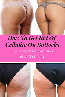How to get rid of cellulite on buttocks naturally
