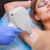 Facts About Undergoing Laser Hair Removal Treatment
