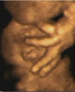 Hafta hafta bebeğin ultrason görüntüleri-35.hafta