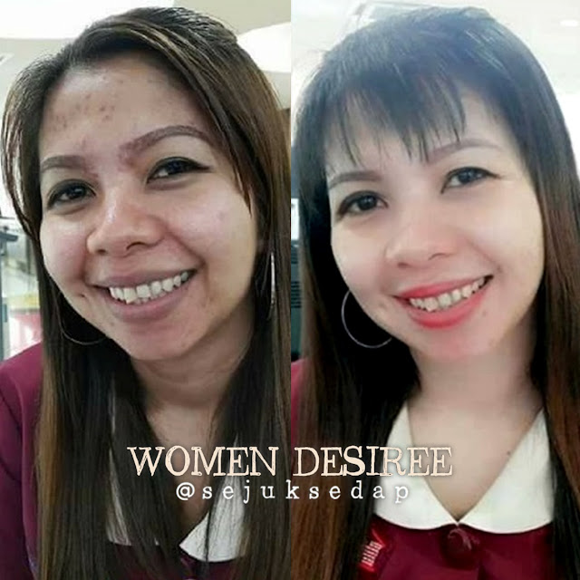 feedback jerawat women desiree _ ainaa serum _ peea dolce lotion feedback jerawat women desiree _ ainaa serum _ peea dolce lotion