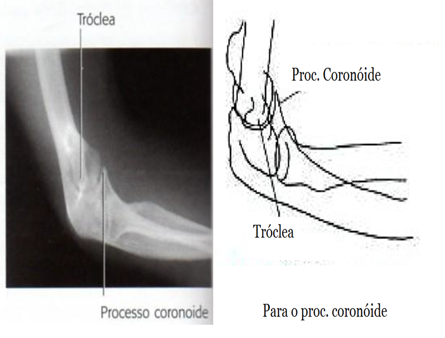 Laboratório de Roentgen: Membros Superiores Parte 2