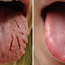 BE AWARE OF THIS: THESE 9 CHANGES ON YOUR TONGUE REVEAL ALMOST ALL YOUR DISEASES