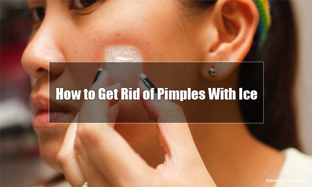 get rid of a painful pimple
