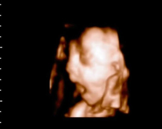 baby yawn scan