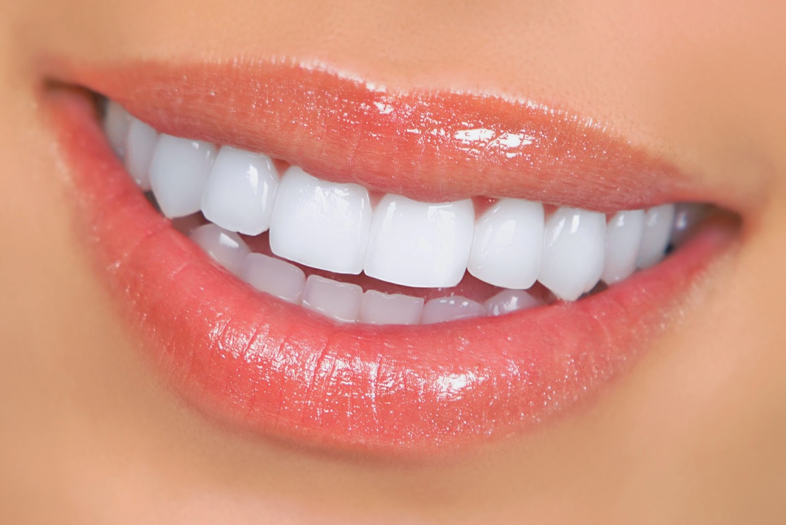 Dental Veneers, Dentists in Brampton, Dental Offices, Dental Info,