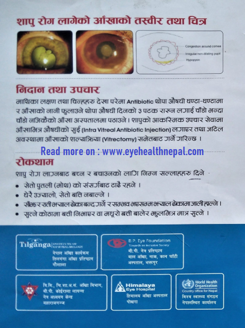 ShAPU Sign and symptoms of SHAPU eye disease