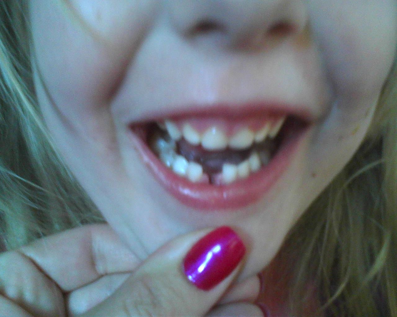 a-fly-on-the-wall-first-tooth-lost