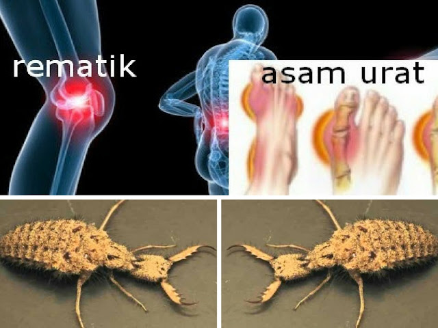 Jarang Diketahui..!! Undur-Undur Dapat Sembuhkan Penyakit Berbahaya.. Jarang Diketahui..!! Undur-Undur Dapat Sembuhkan Penyakit Berbahaya..