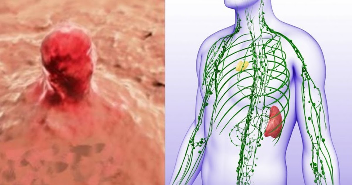 All Lymph Nodes In Body