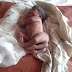 सहजनवा गोरखपुर :  सीएचसी पर पैदा हुआ चार पैर और दो लिंग वाला बच्चा , बच्चे की हालत खराब जिला अस्पताल के लिये हुए रेफर