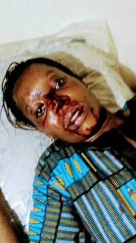 Photos: Young lady almost beaten to death by her boyfriend