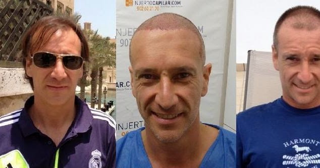 Alfonso+Reevoluci%C3%B3n+capilar.jpg