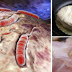STOP EATING THESE 8 FOODS THAT CAUSE CANCER – ONCOLOGISTS WARN YOU!