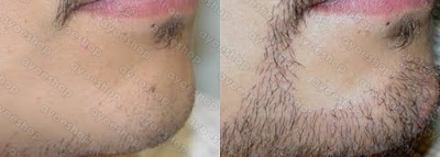 Image Result For Rahasia Cara Cepat Menumbuhkan Dan Melebatkan Rambut Image Result For Rahasia Cara Cepat Menumbuhkan Dan Melebatkan Rambut