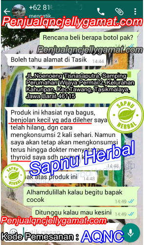 Cara Mengobati Nodul Tiroid Secara Alami Cara Mengobati Nodul Tiroid Secara Alami