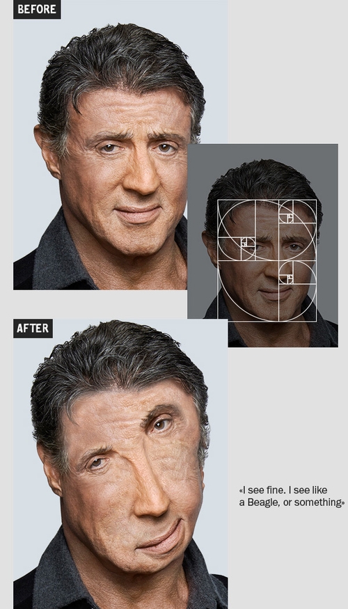 04-Sylvester-Sly-Stallone-Igor-Kochmala-Plastic-Surgery-using-the Fibonacci-Sequence-www